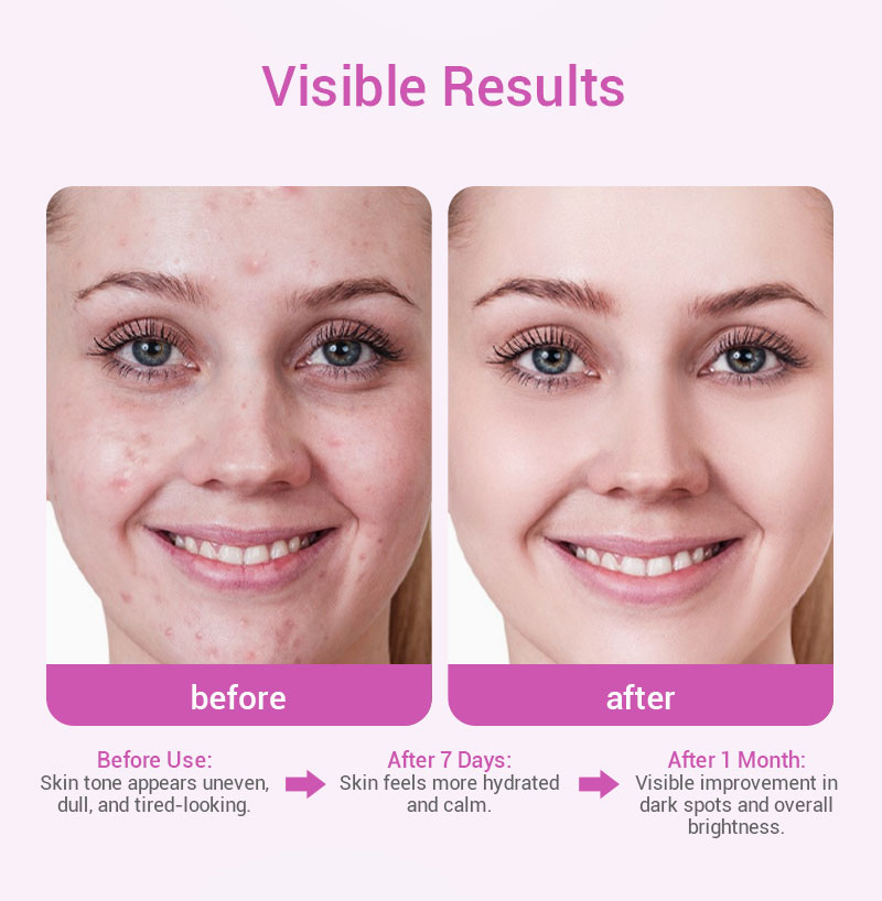 private label tranexamic acid serum pink bottle